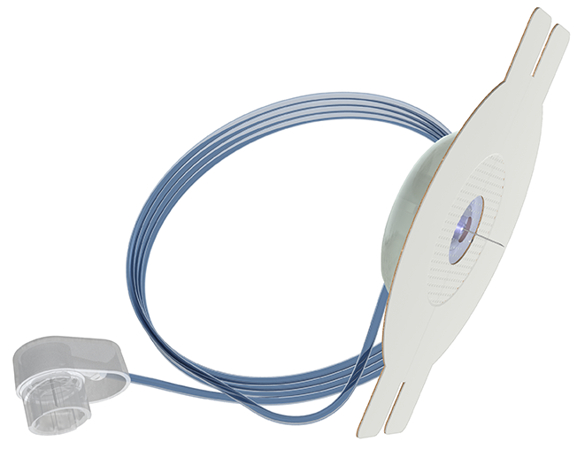 mylife Orbitsoft YpsoPump Steel Infusion Sets